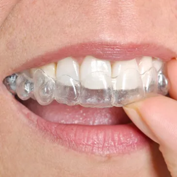 Invisalign