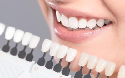 Cosmetic Dentistry – What It Is, Procedures, and Types…