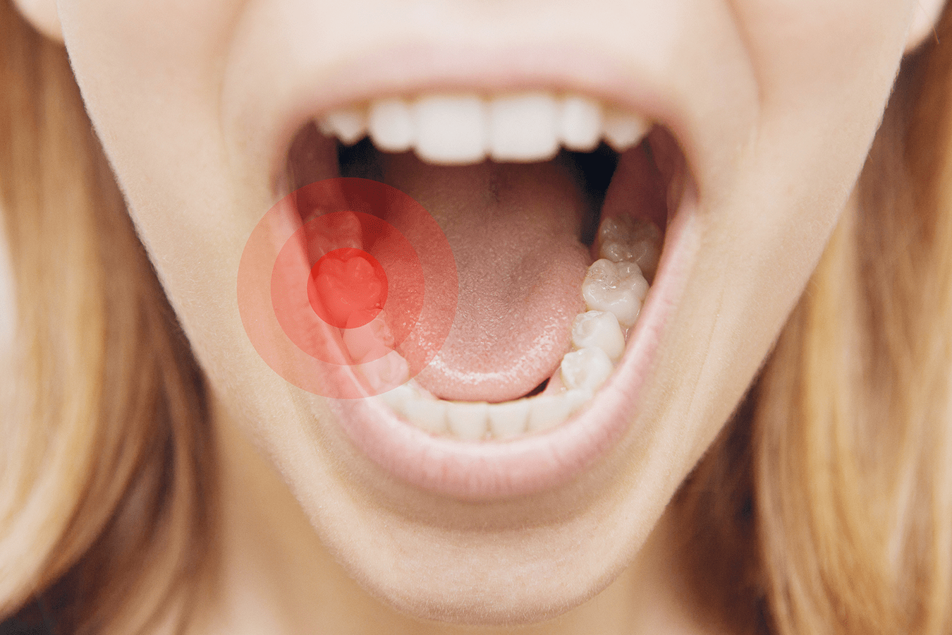 The Ultimate Guide to Understanding and Treating Toothaches…
