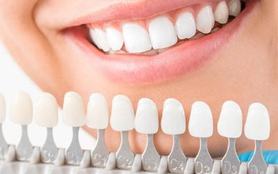 A Comprehensive Guide To Restorative Dentistry Procedures…